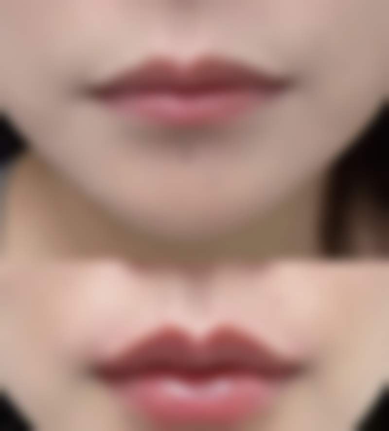 不同阶段的修复特点