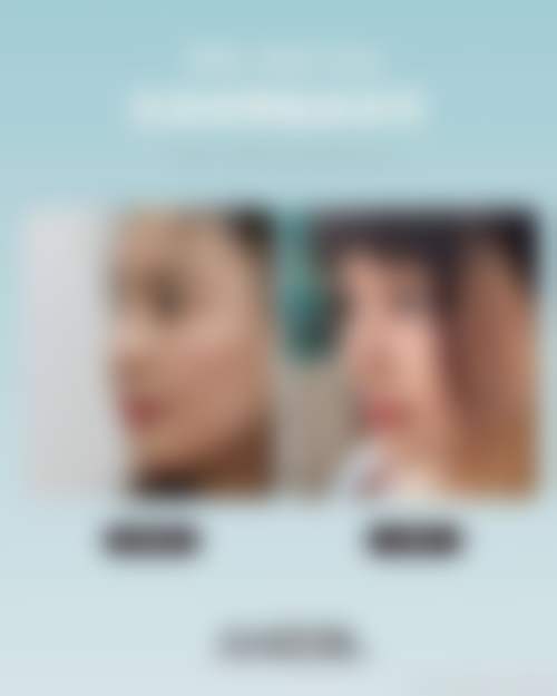 七、扬州华美整形门诊部顾客实例展示