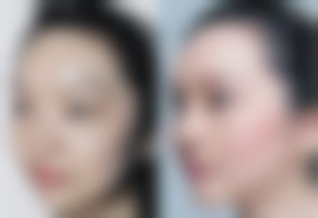 深圳盛美佳整形医院