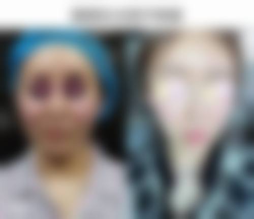 上海嘉定区中 心医院医院技术好不好？