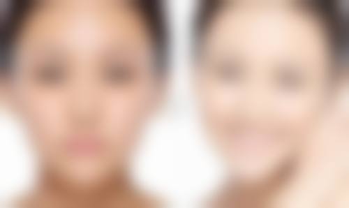 哈尔滨市李奇医疗美容门诊部收费标准参考