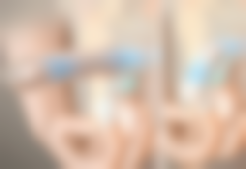 面部吸脂的修复阶段