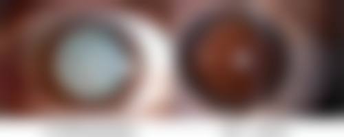 热门疤痕消除膏的特点和用户评价