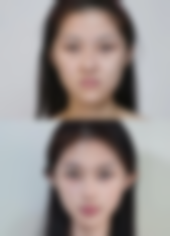 总结——香港NUME名人医美外科中 心怎么样？