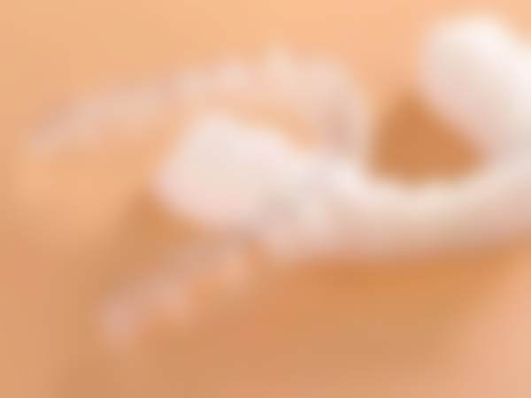 隐适美牙套图片