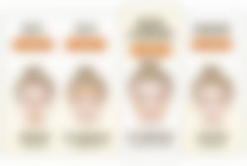 双眼皮宽改窄修复有哪些改窄方法