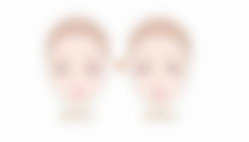 总结——深圳润泽瑞尼丝医疗美容门诊部胡珍珍医生怎么样？