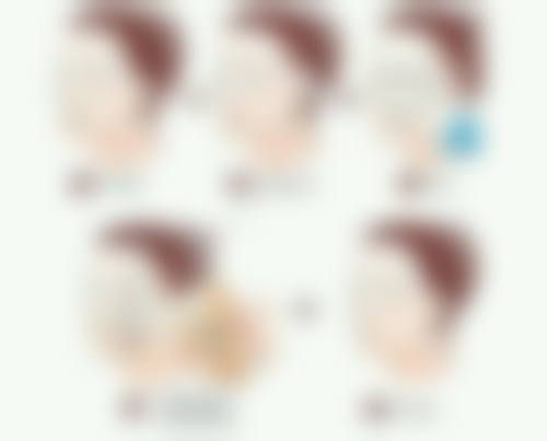 哪里可以看到双眼皮宽改窄修复3D动画演示