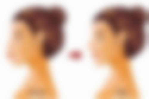 湛江一欧整形医院收费标准参考