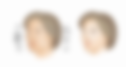 滁州兰积医疗美容诊所收费标准参考