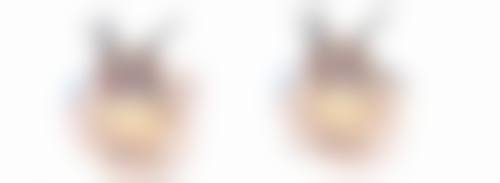 割眼袋提升面部受哪些因素影响？