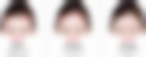 湖北十堰绽颜整形收费标准参考