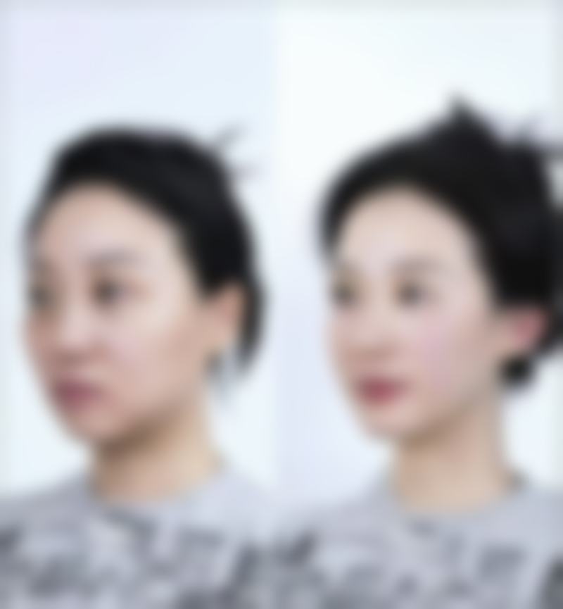 蚌埠康美整形美容医院收费标准参考