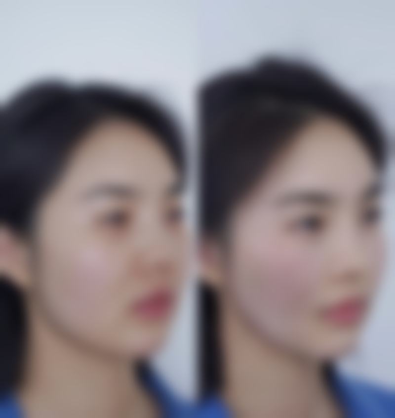 眼部按摩的注意事项