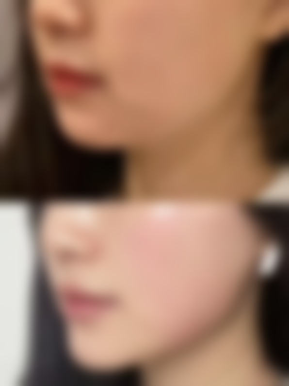 双眼皮眼睛不大的原因