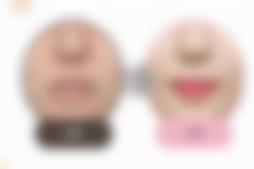 广州番禺区雍禾史云逊植发医院营业时间