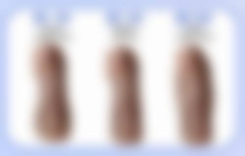 下颌骨整形的风险怎么样