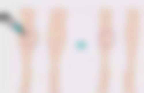 西安内确整形医院收费标准参考