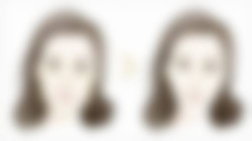 二次双眼皮修复的疼痛特点