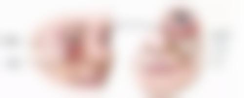 无锡菲尚整形医疗美容门诊部口碑如何？