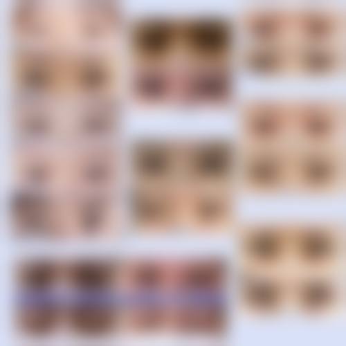 八、北京爱美汇医疗美容诊所用户真实实例