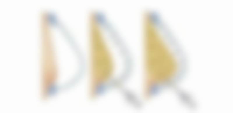 大连爱德丽格眼部整形项目2026年价格是多少？