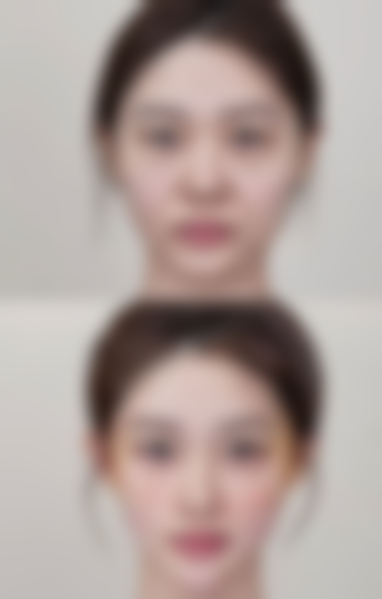 广州番禺区雍禾史云逊植发医院口碑如何？