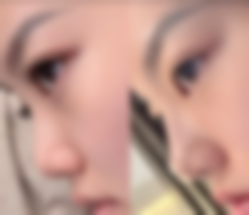 小野市美容皮肤科口碑如何？