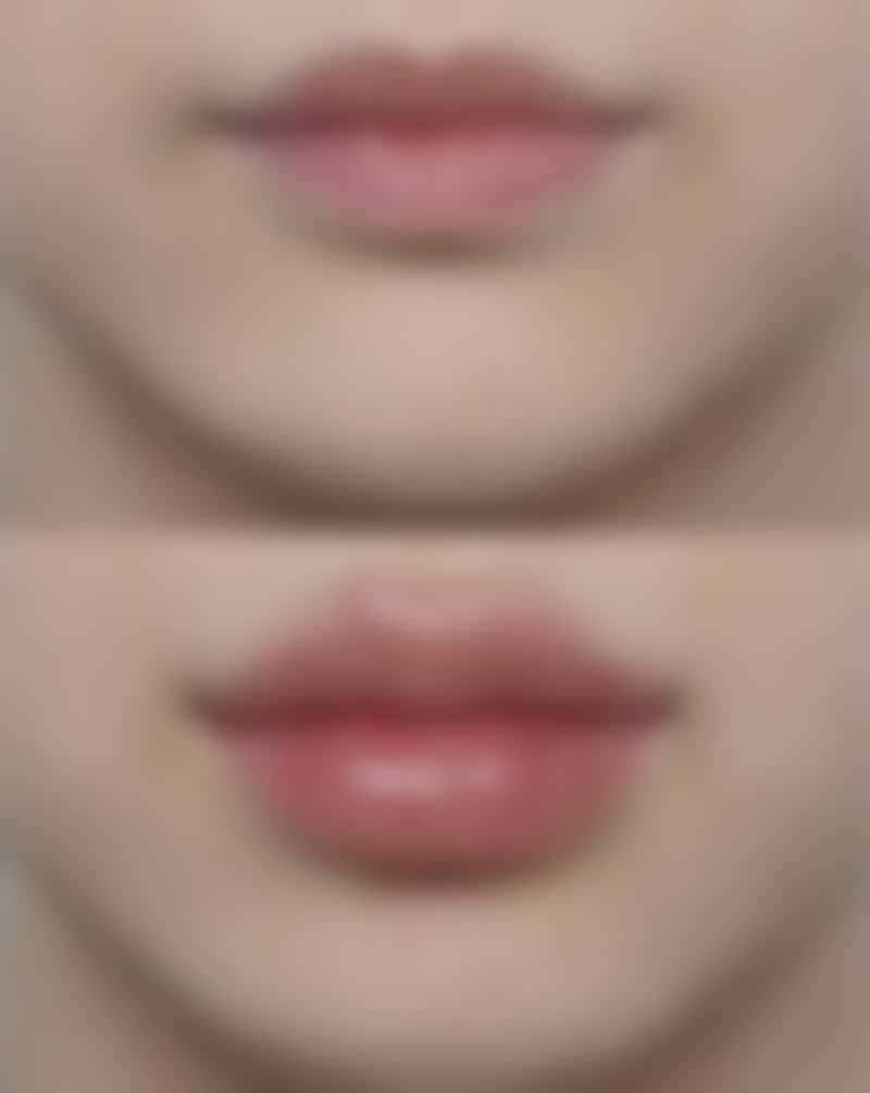 下颌骨整形的价格怎么样