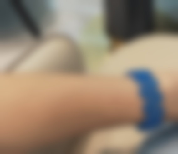 广州中家医家庭医生手臂脱毛：告别绒毛，宋医生贴心操作仅等待稍久