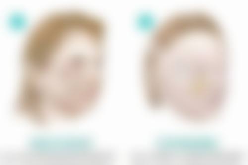 内江文华医疗美容诊所文惠英医生技术好不好？