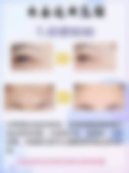 非手术去眼袋的优势