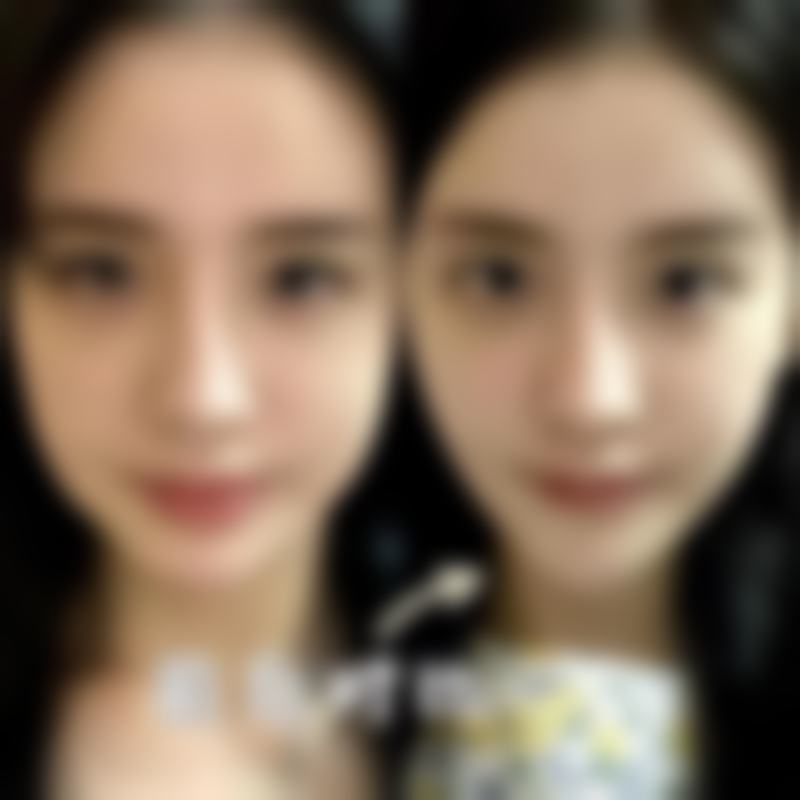 生活护理保护疤痕快速修复正常