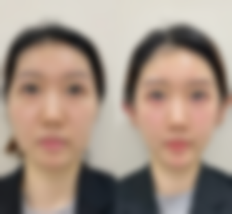 深圳蒙恩齿科诊所王玢医生技术好不好？