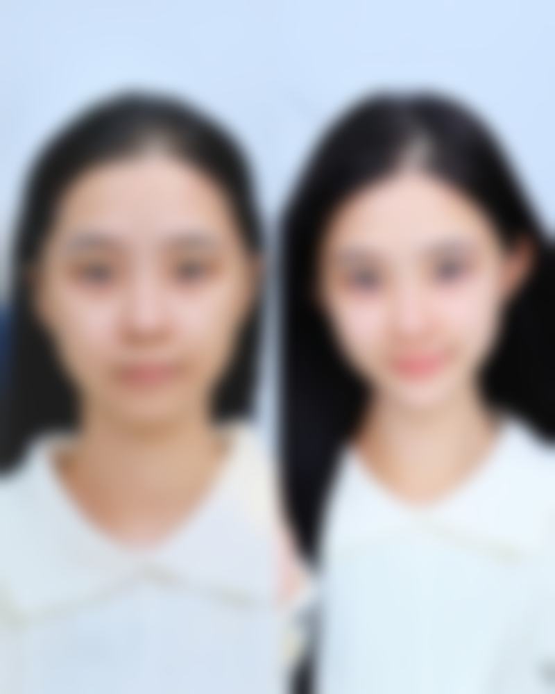 总结——内江文华医疗美容诊所文惠英医生怎么样？