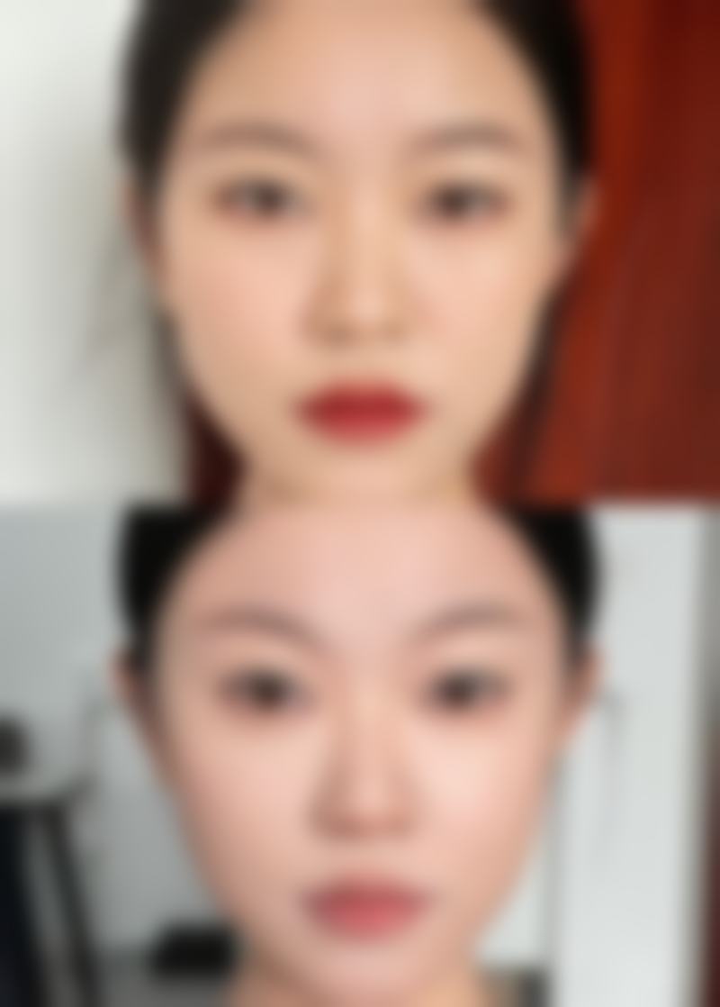 饮食调理快速消除眼袋