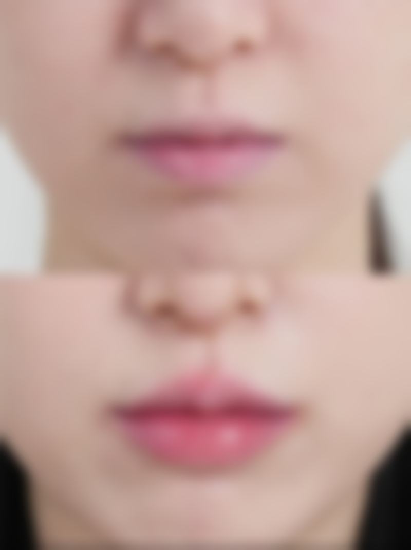 干眼症影响眼部舒适