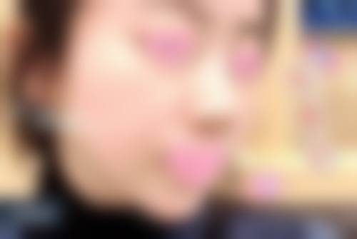 总结——衡阳鑫雅韩医疗美容门诊部怎么样？