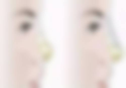 嘉兴兮颜棠整形医院地址