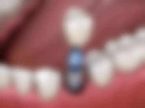 三、通海管秀莹口腔诊所医生介绍: