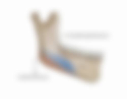 物理治疗痤疮留下的疤痕疙瘩