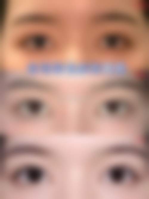 总结——吉林大学第一医院整形美容科金洪娟医生怎么样？