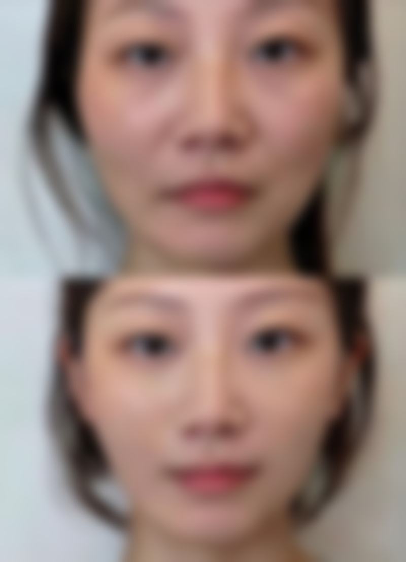 一些有医生院做假体隆胸的相关信息
