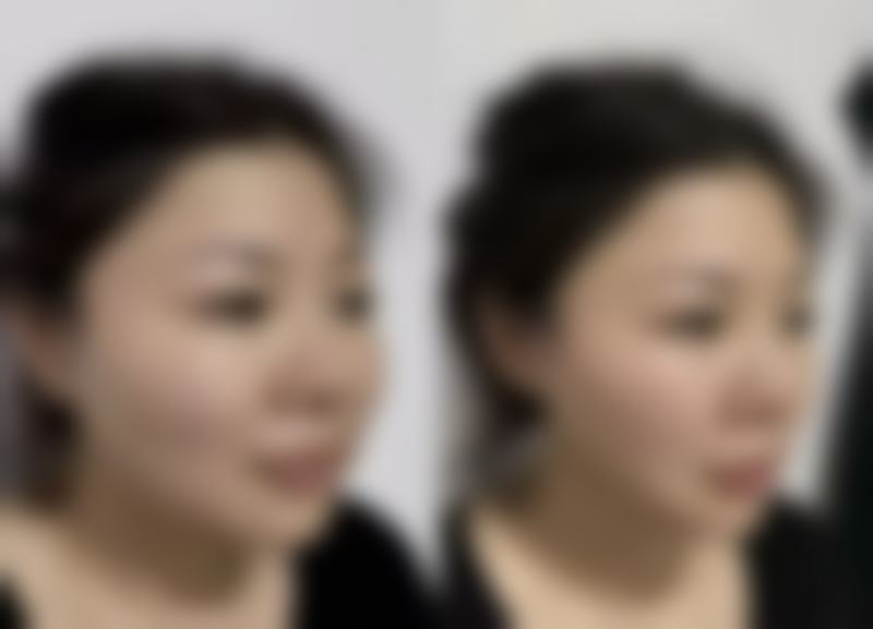 长期坚持保养预防眼袋