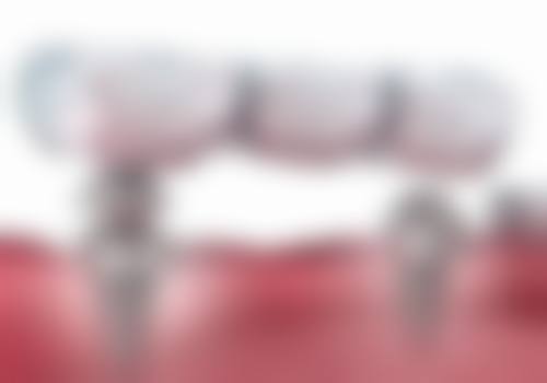 八、伊犁永健加程口腔诊所用户真实实例