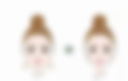双眼皮手术后不宜立即做光子嫩肤的原因