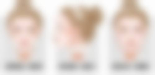 总结——保定悦美医疗美容门诊部刘晓飞医生怎么样？