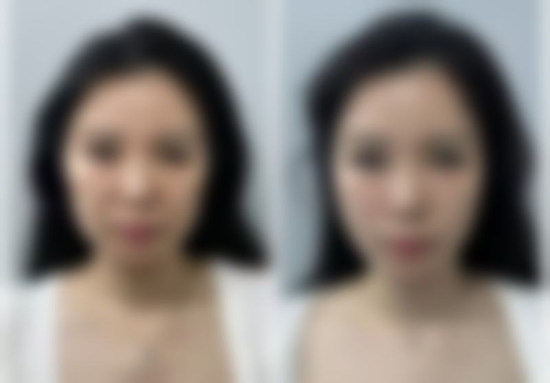 总结——运城雅都整形美容门诊部怎么样？