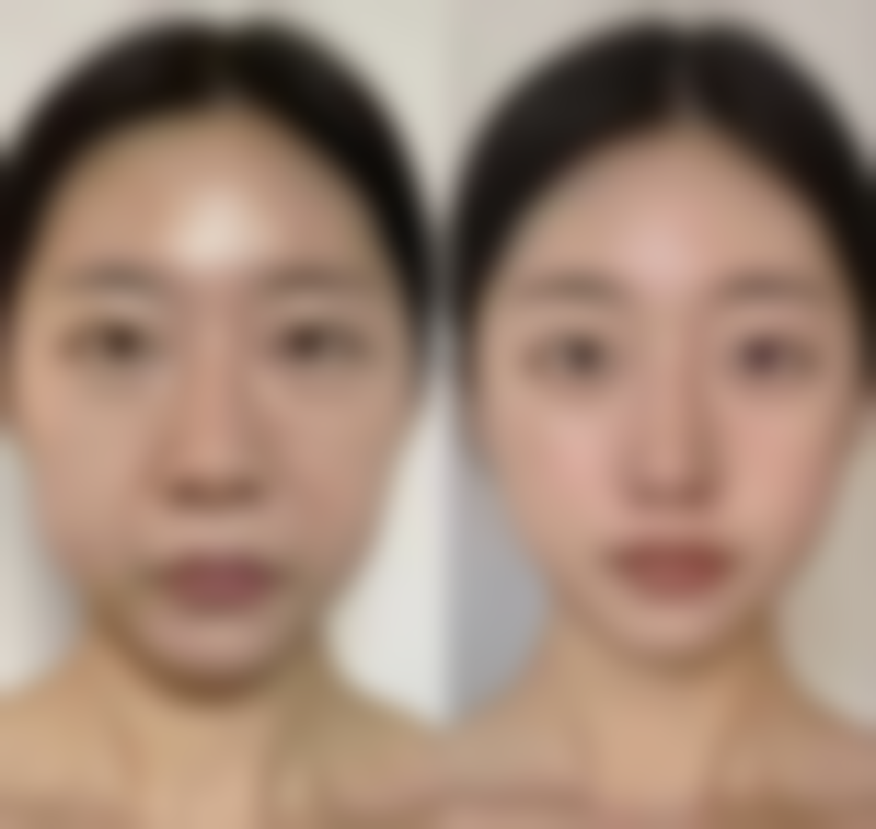 总结——太原美雅枫整形美容门诊部怎么样？