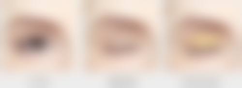 昆明美眼医疗美容诊所医院技术好不好？